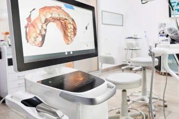 iTero Intraoral Scanner