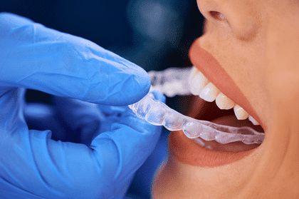 invisalign aligners new york